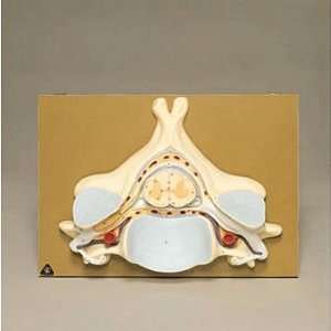 Somso Human Spinal Cord Section Model  Industrial 