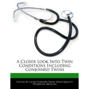  A Closer Look Into Twin Conditions Including Conjoined Twins 